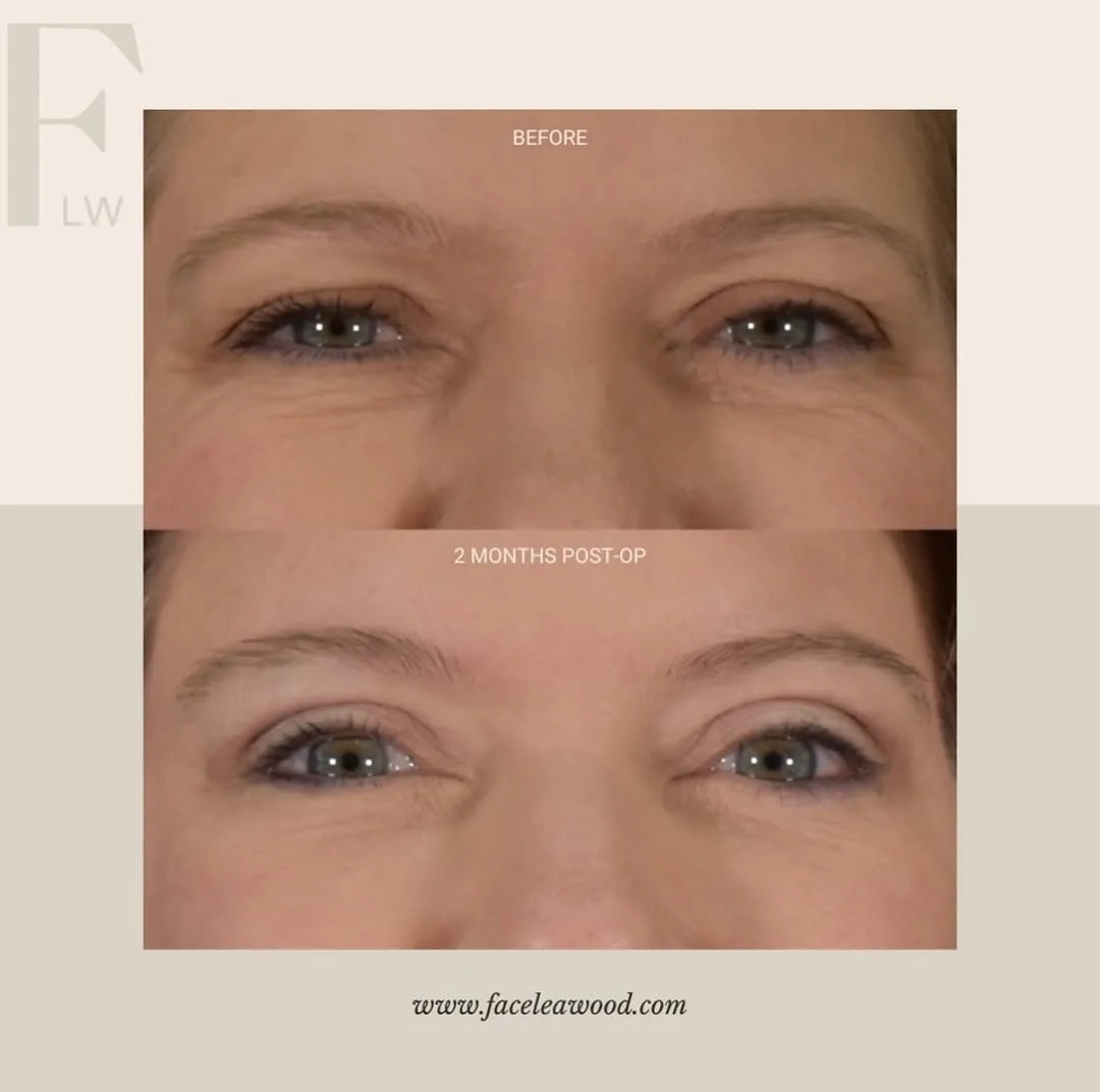 Before and after — Dr. Lauren Umstattd