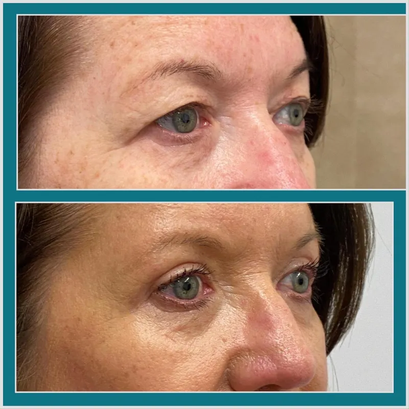 Before and after: Dr. Lewis Blennerhassett