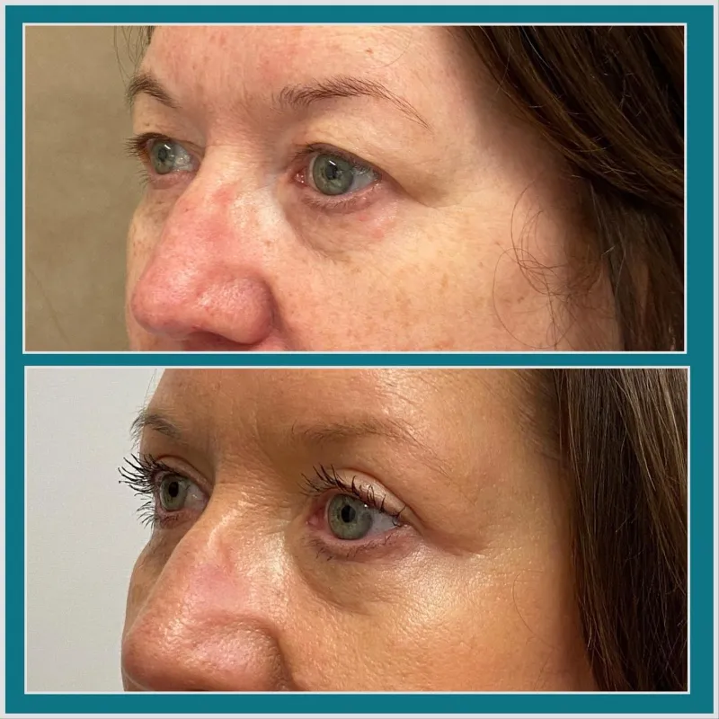 Before and after: Dr. Lewis Blennerhassett