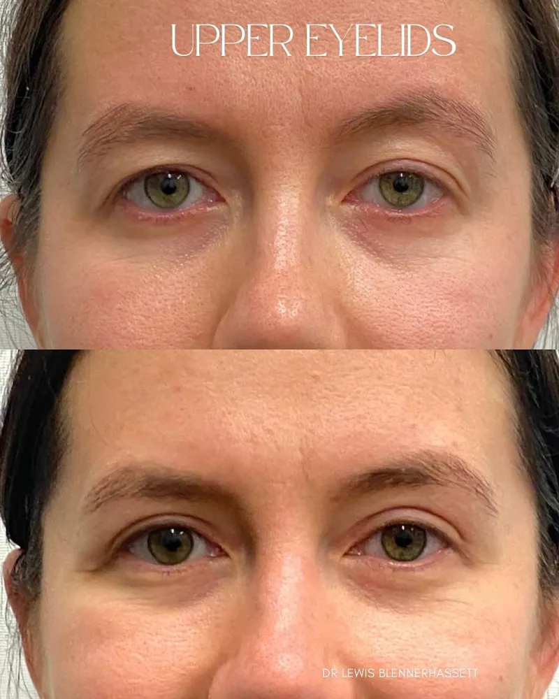Before and after: Dr. Lewis Blennerhassett