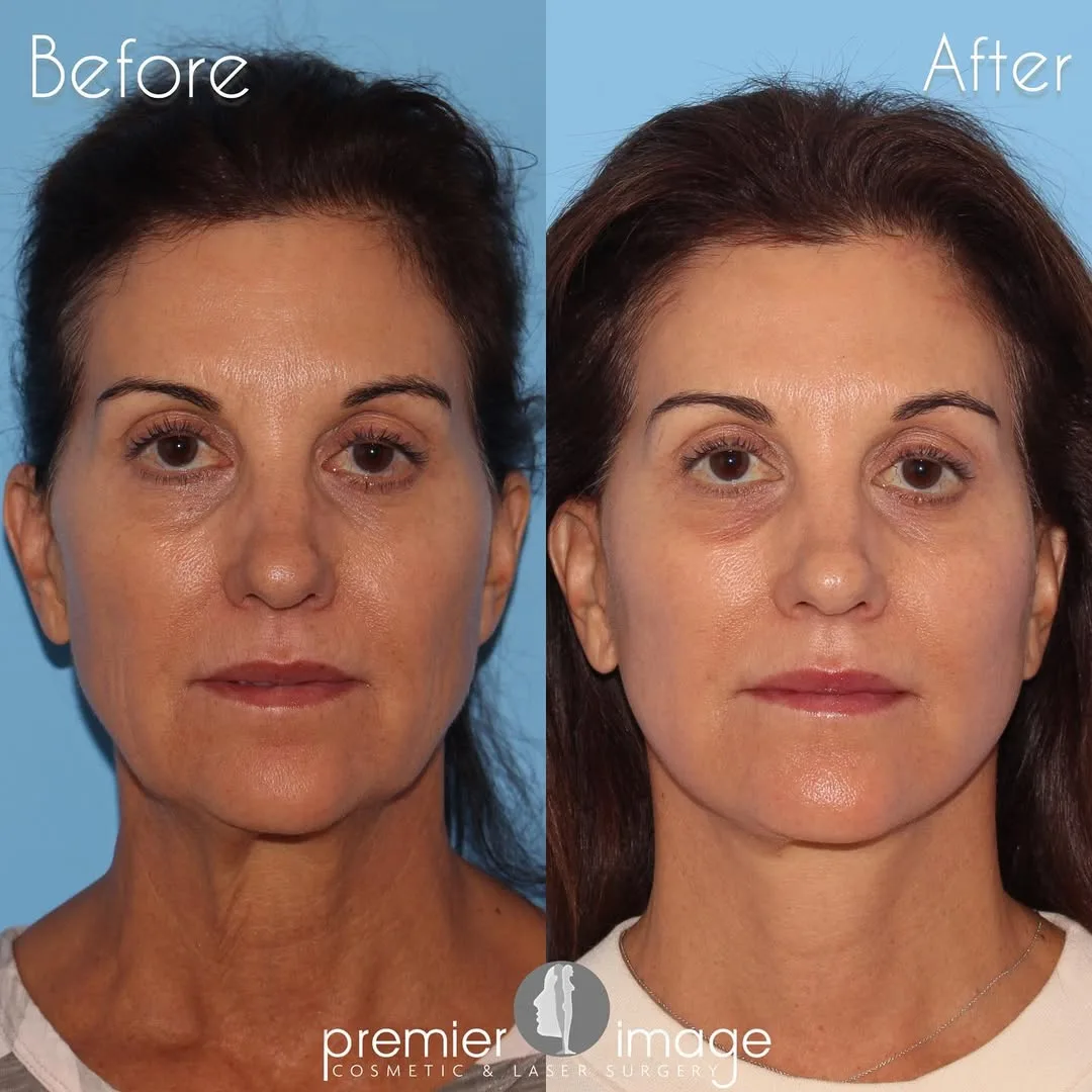 Before and after — Dr. Louis DeJoseph