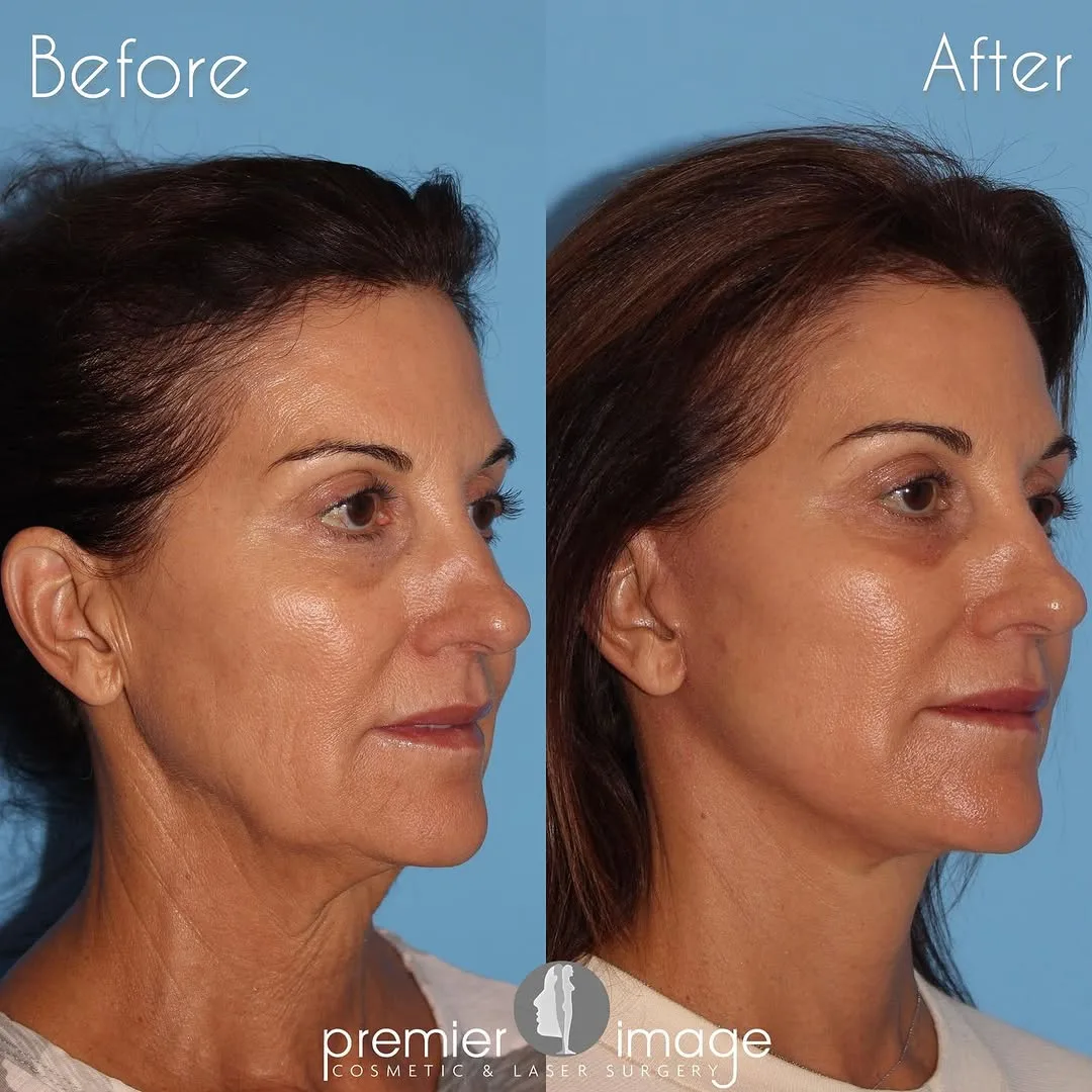 Before and after — Dr. Louis DeJoseph