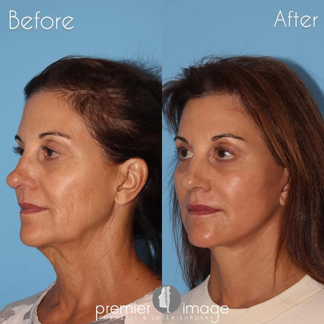 Before and after — Dr. Louis DeJoseph