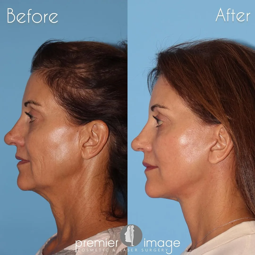 Before and after — Dr. Louis DeJoseph