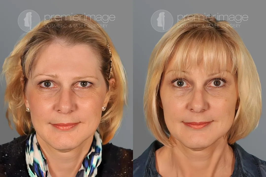 Before and after: Dr. Louis DeJoseph