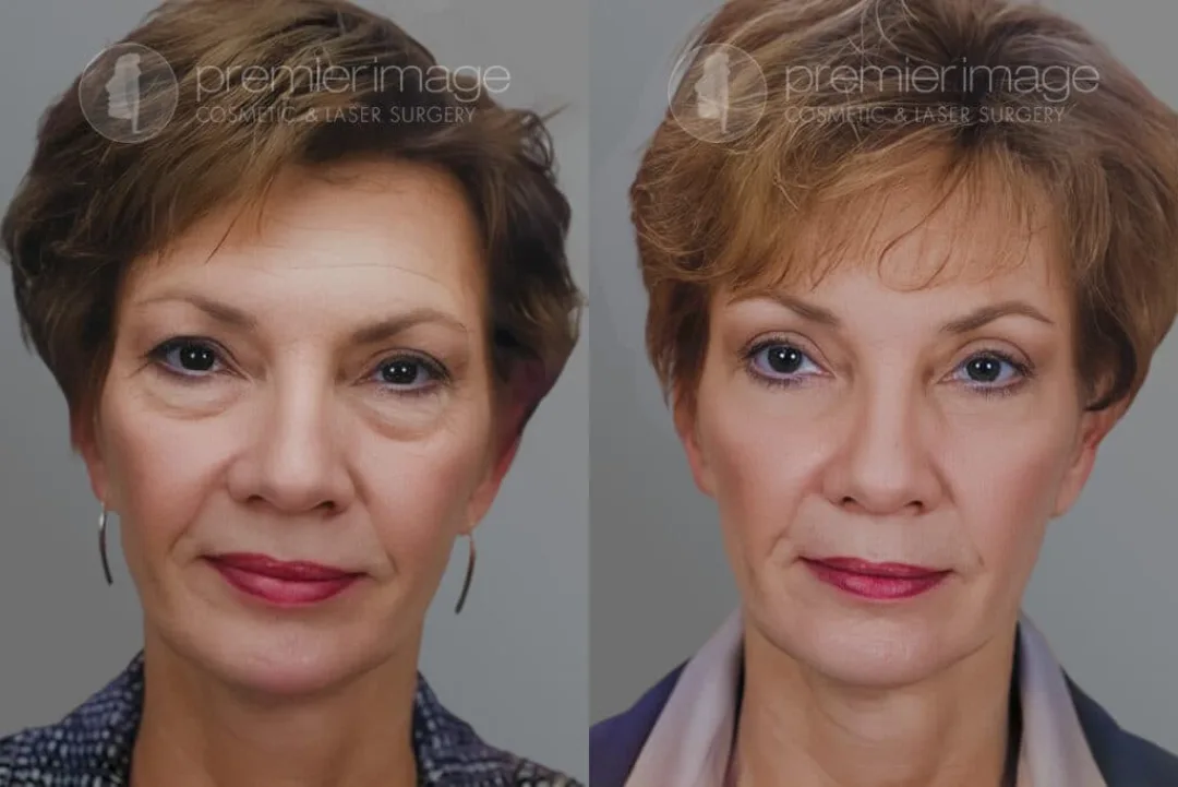 Before and after: Dr. Louis DeJoseph