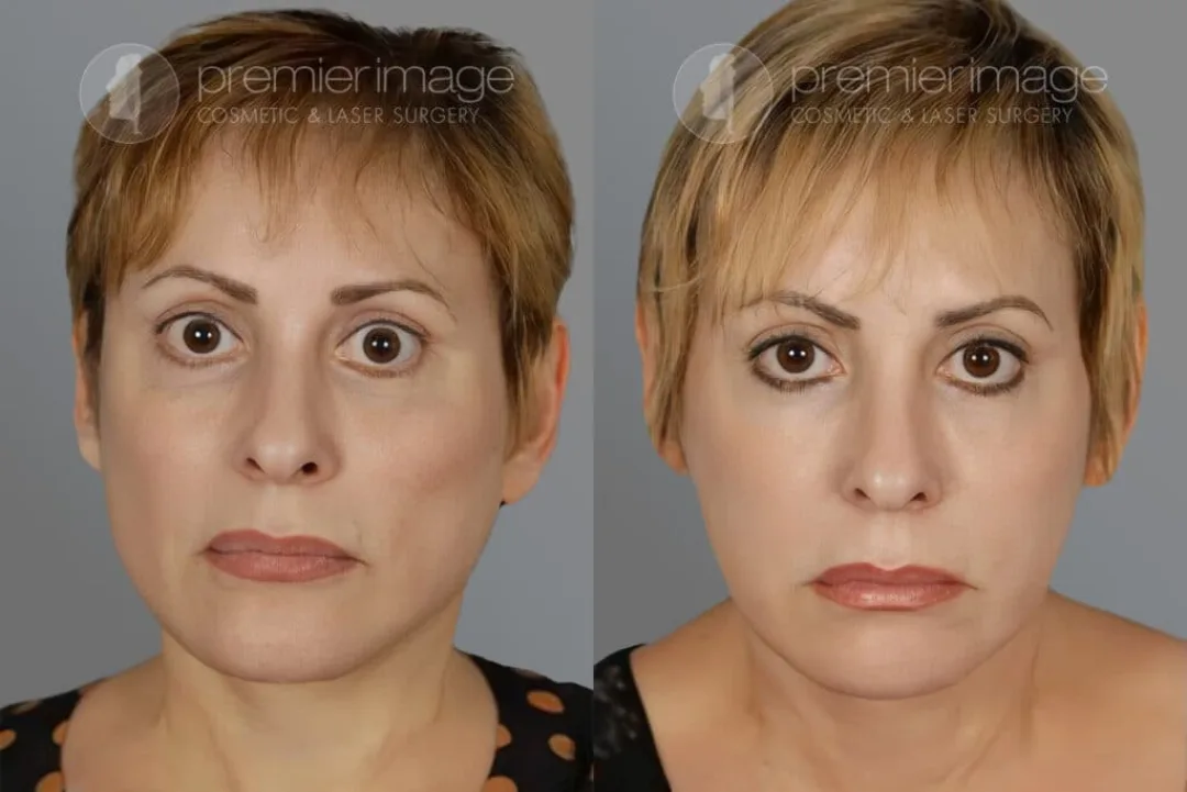 Before and after: Dr. Louis DeJoseph