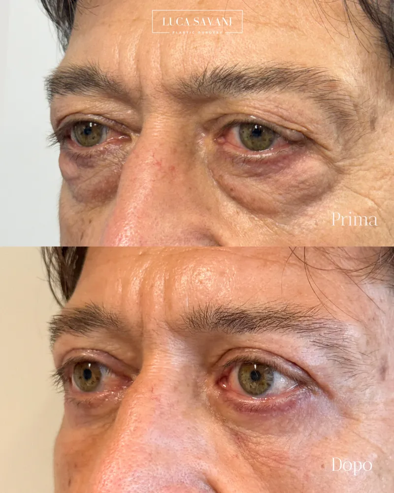 Before and after: Dr. Luca Savani