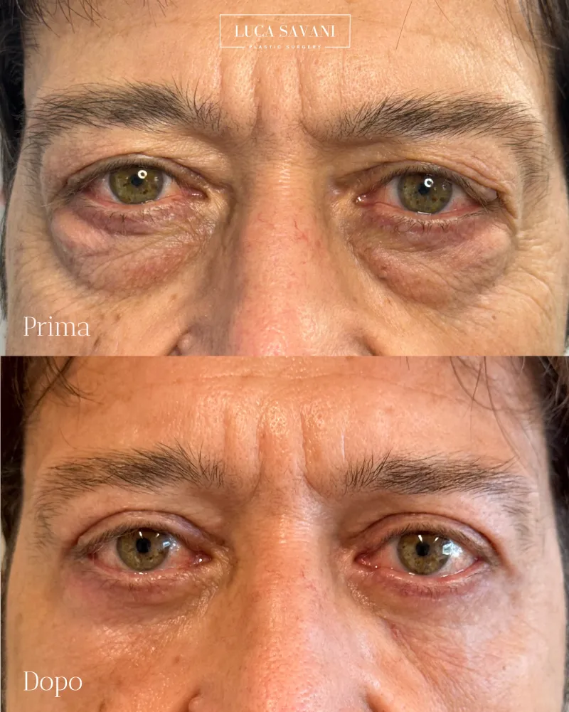 Before and after: Dr. Luca Savani
