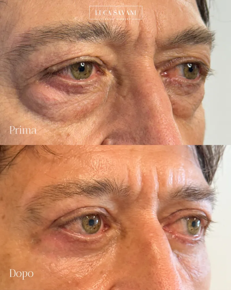 Before and after: Dr. Luca Savani