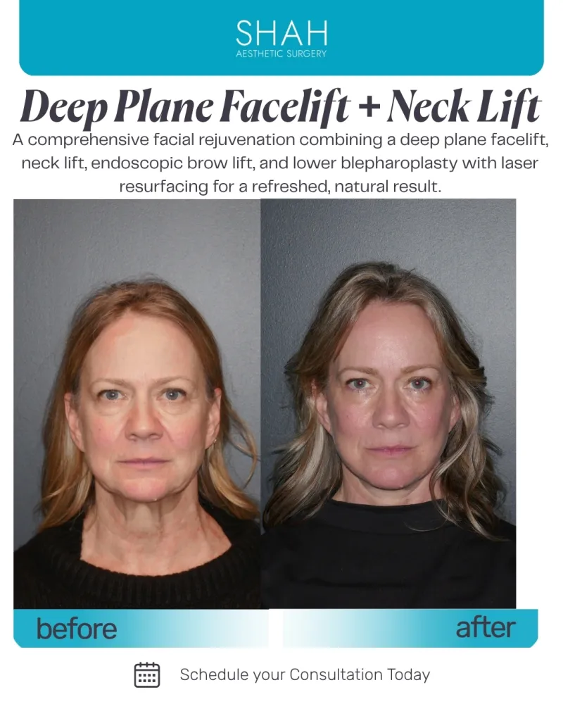 Before and after: Dr. Manish Shah