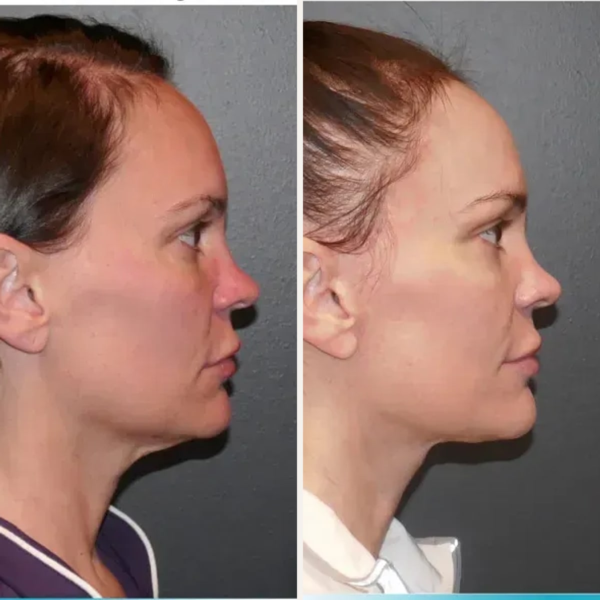 Before and after: Dr. Manish Shah