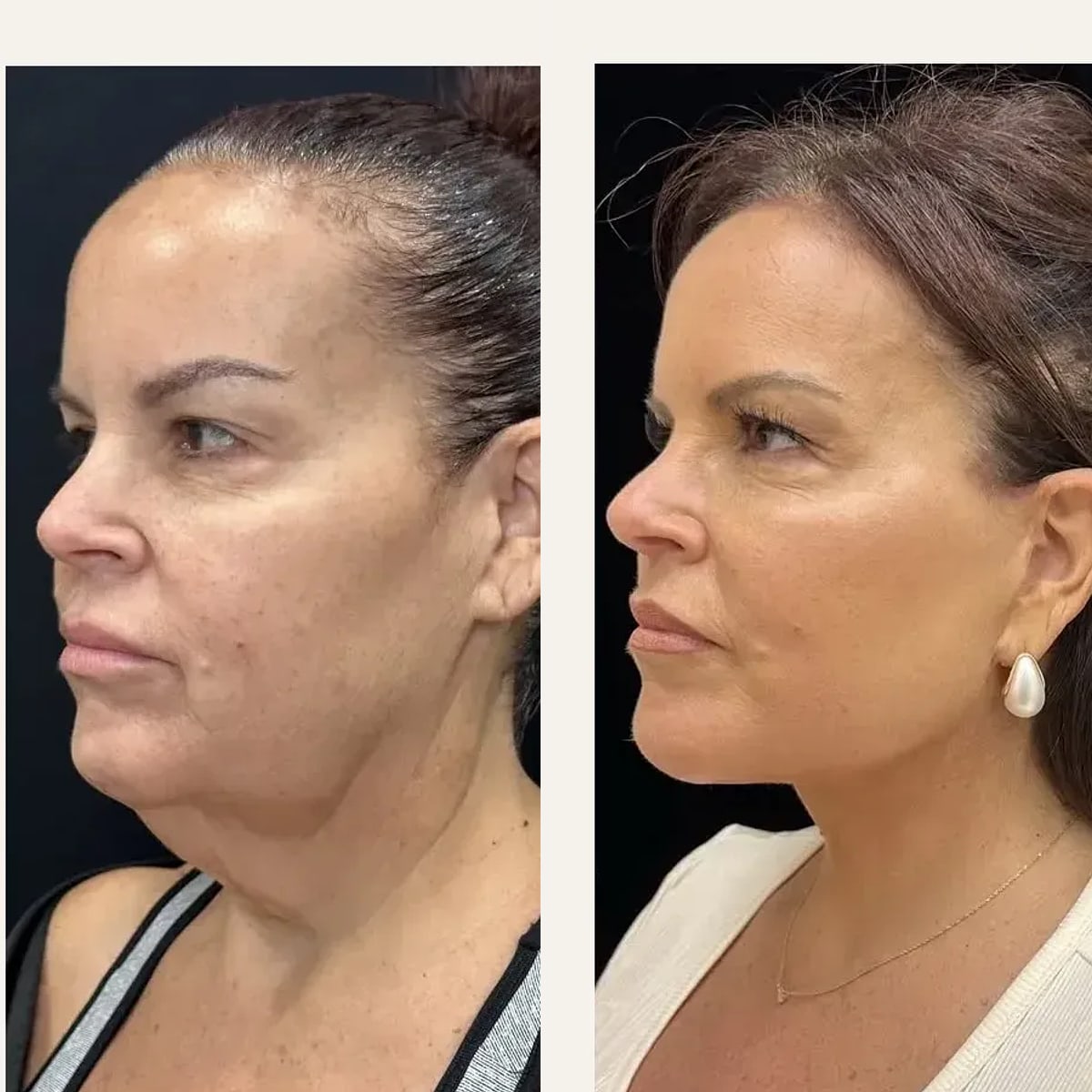 Before and after: Dr. Mansher Singh