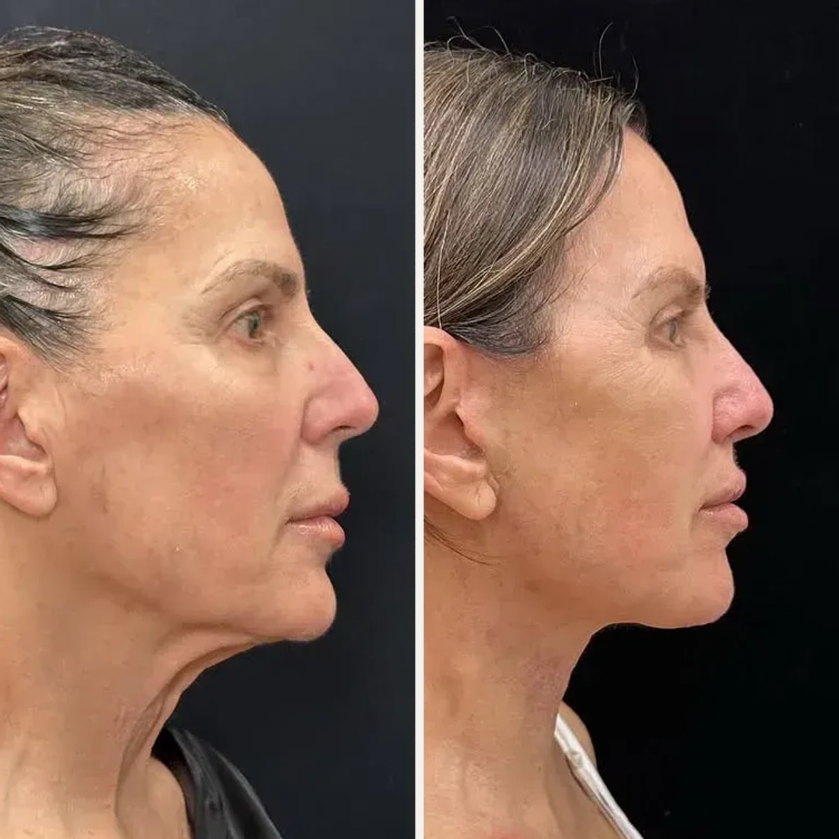Before and after: Dr. Mansher Singh