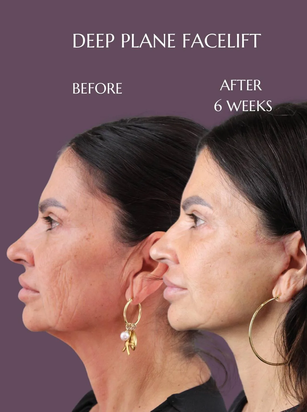 Before and after — Dr. Mara Teresa Sierra