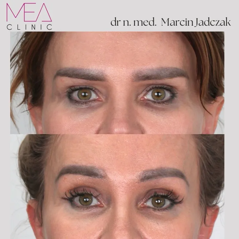 Before and after: Dr. Marcin Jadczak