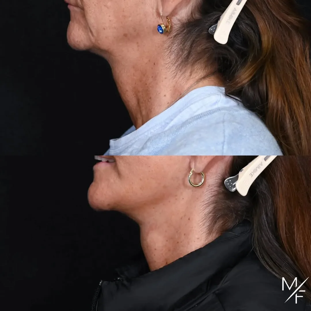Before and after — Dr. Mark Fisher