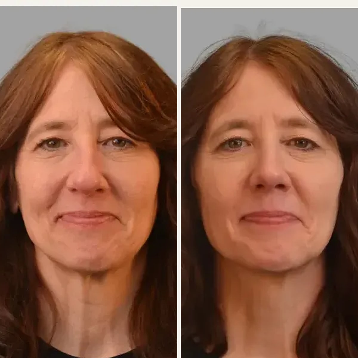 Before and after: Dr. Mark Ginsburg