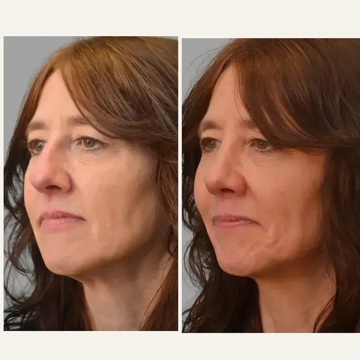 Before and after: Dr. Mark Ginsburg