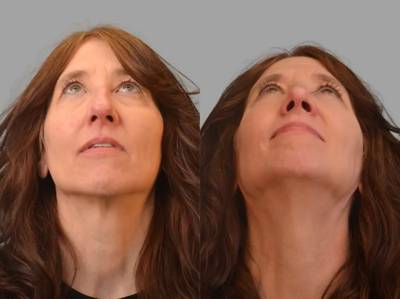 Before and after: Dr. Mark Ginsburg
