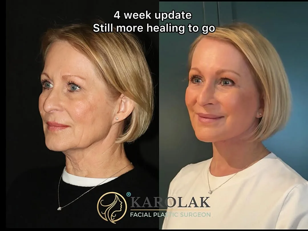 Before and after — Dr. Mark Karolak