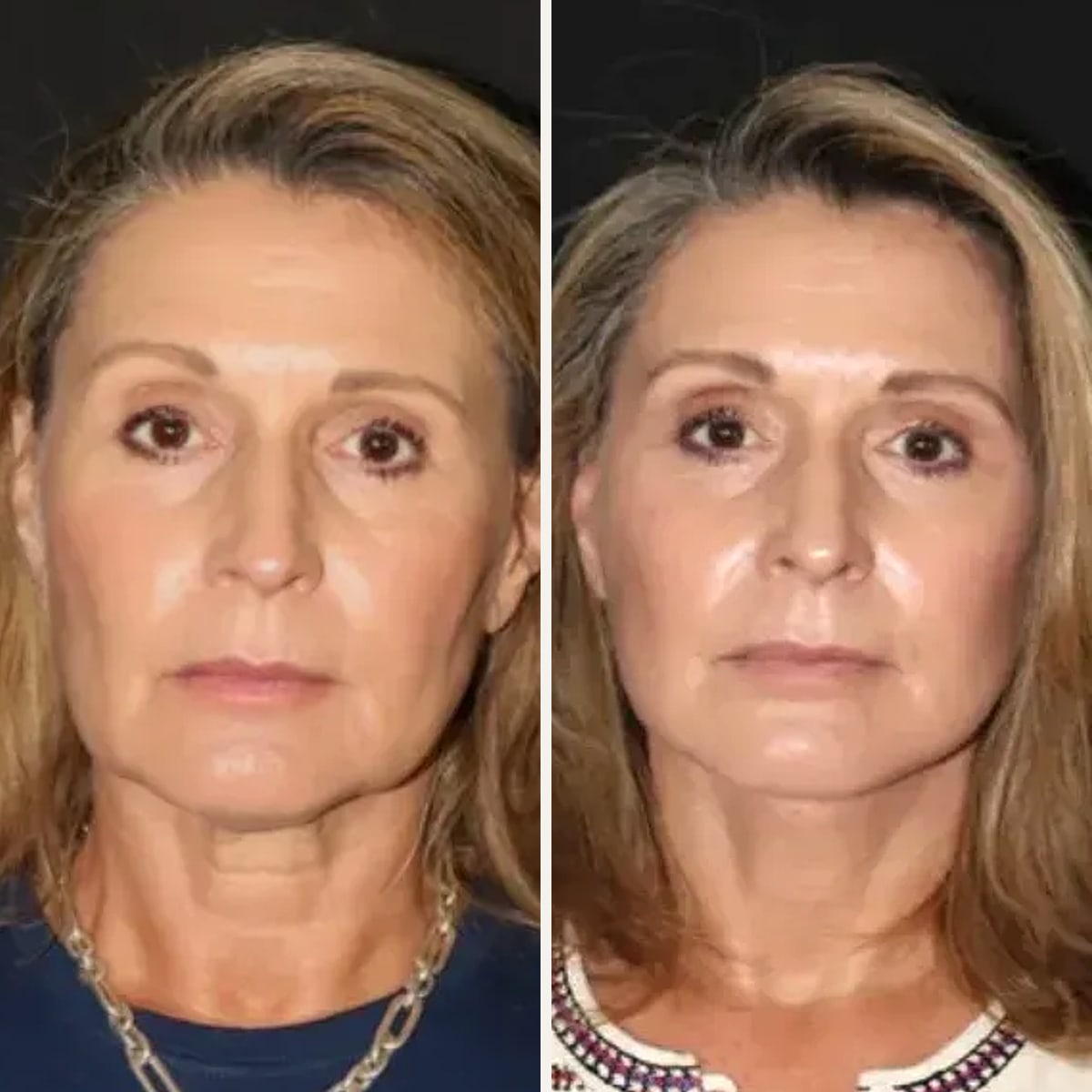 Before and after: Dr. Mark Karolak