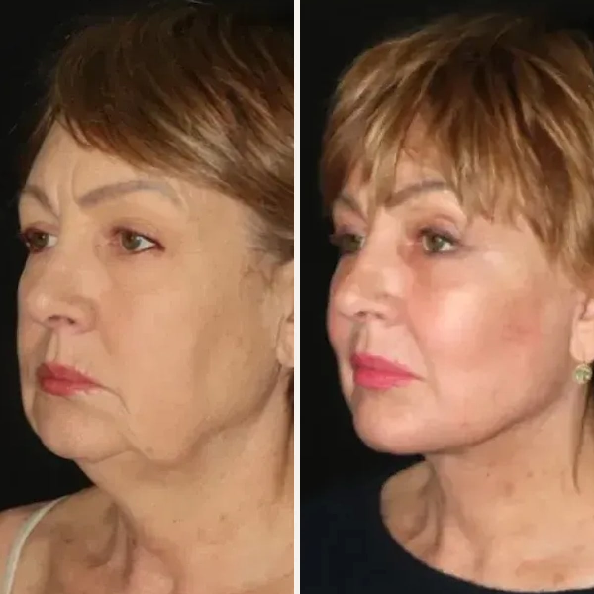 Before and after: Dr. Mark Karolak