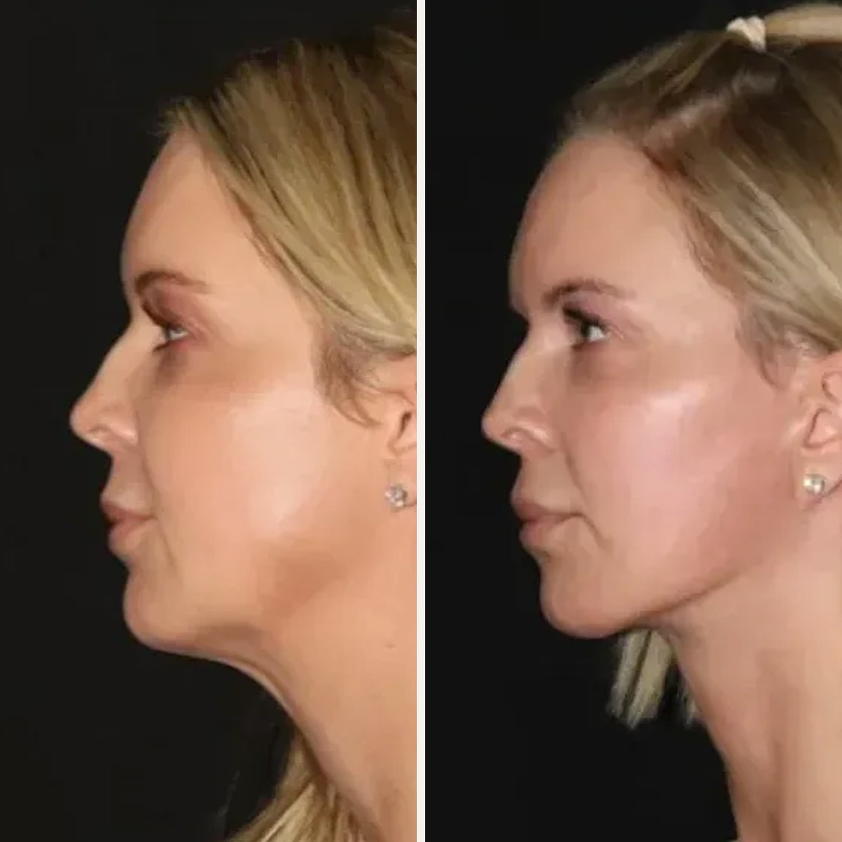 Before and after: Dr. Mark Karolak