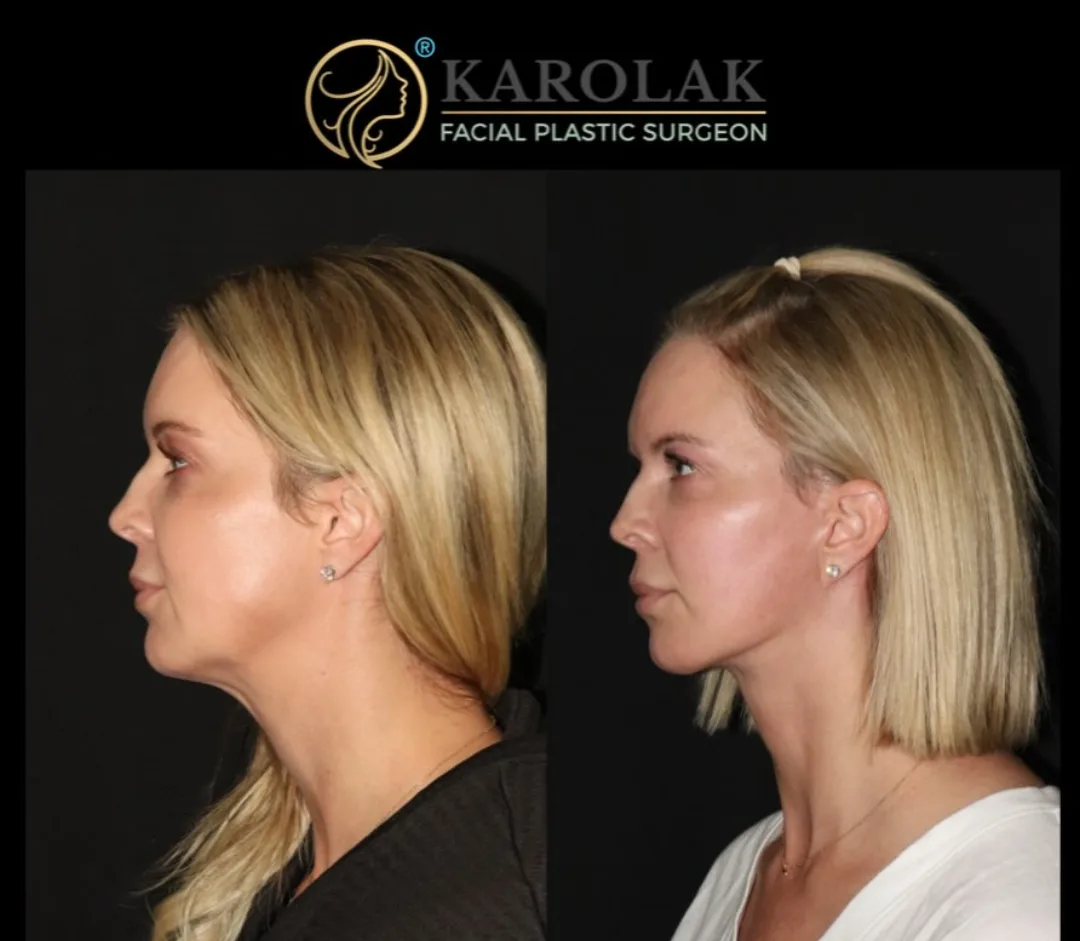 Before and after — Dr. Mark Karolak