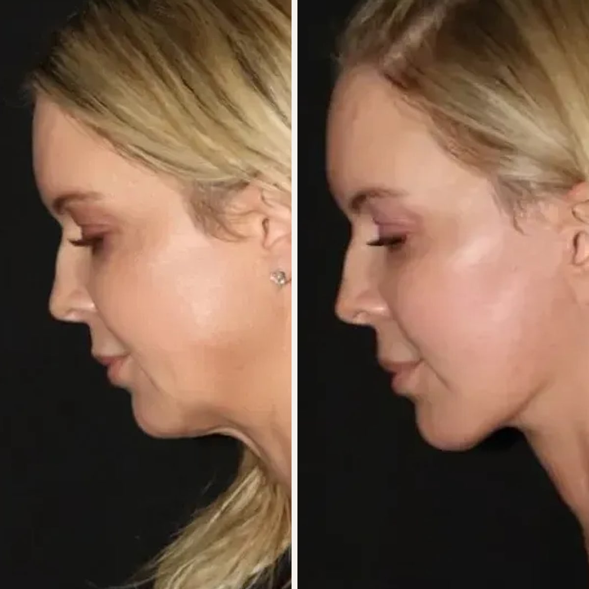 Before and after: Dr. Mark Karolak