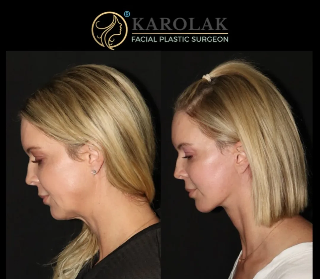 Before and after — Dr. Mark Karolak