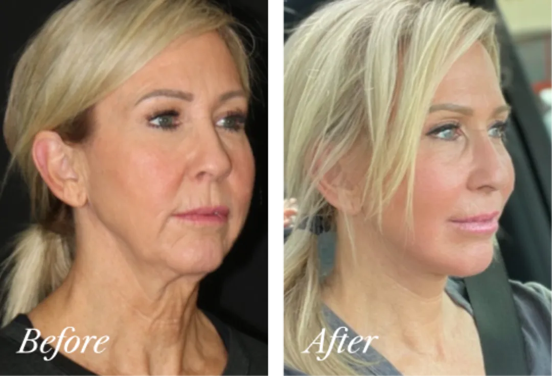 Before and after — Dr. Mark Karolak