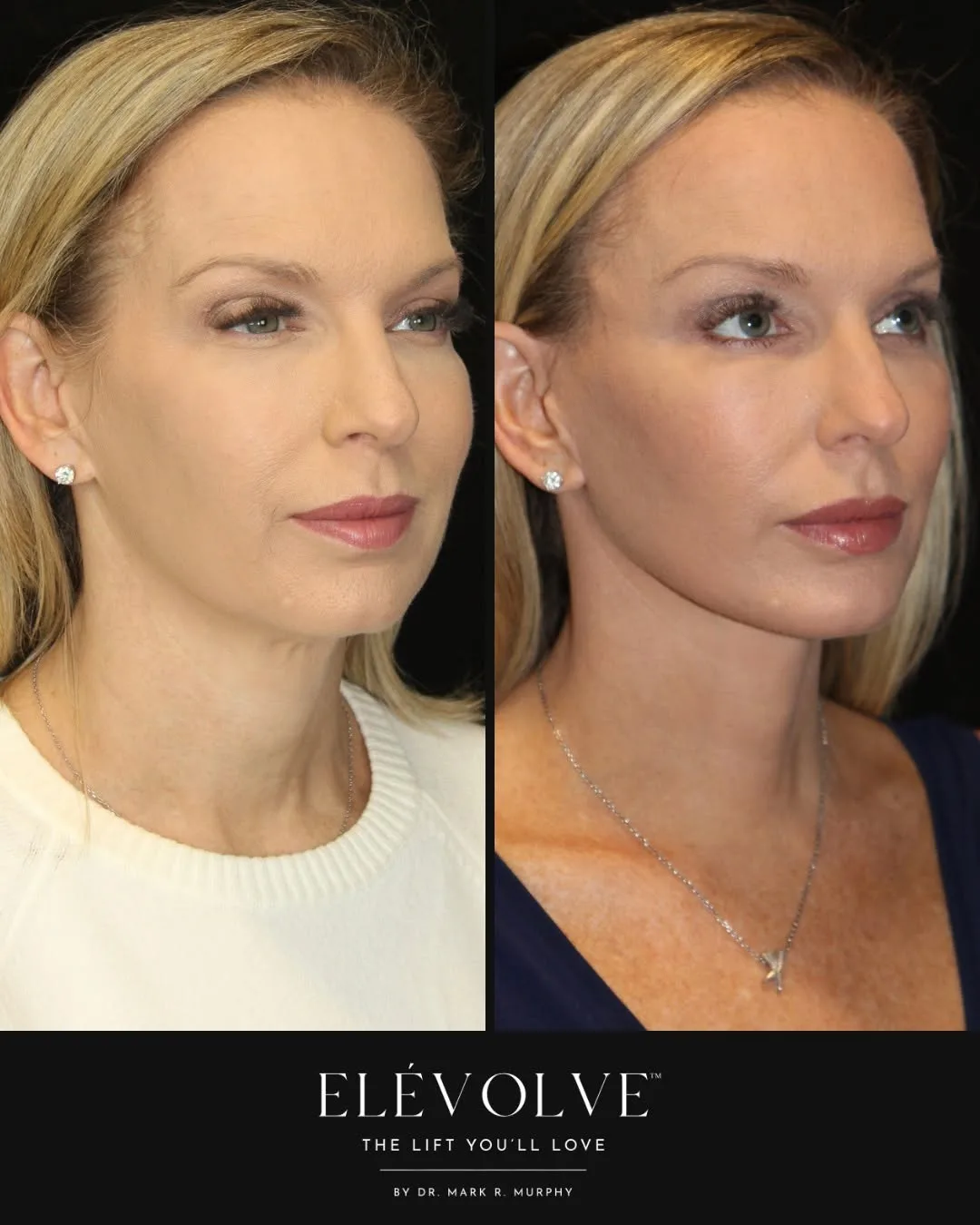 Before and after — Dr. Mark R. Murphy