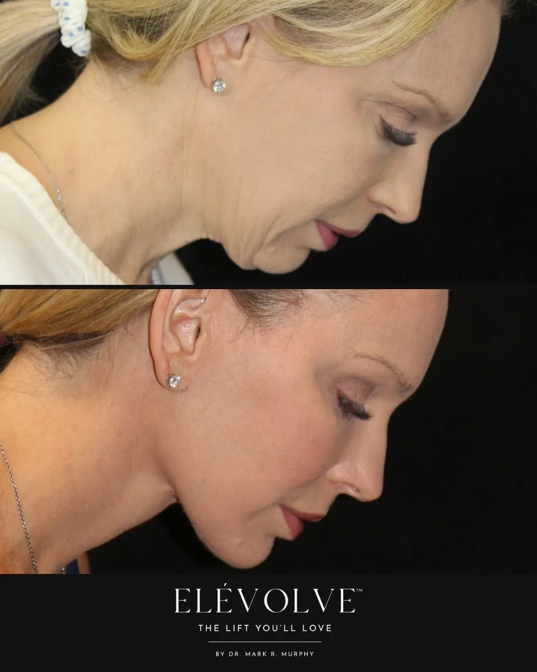 Before and after — Dr. Mark R. Murphy