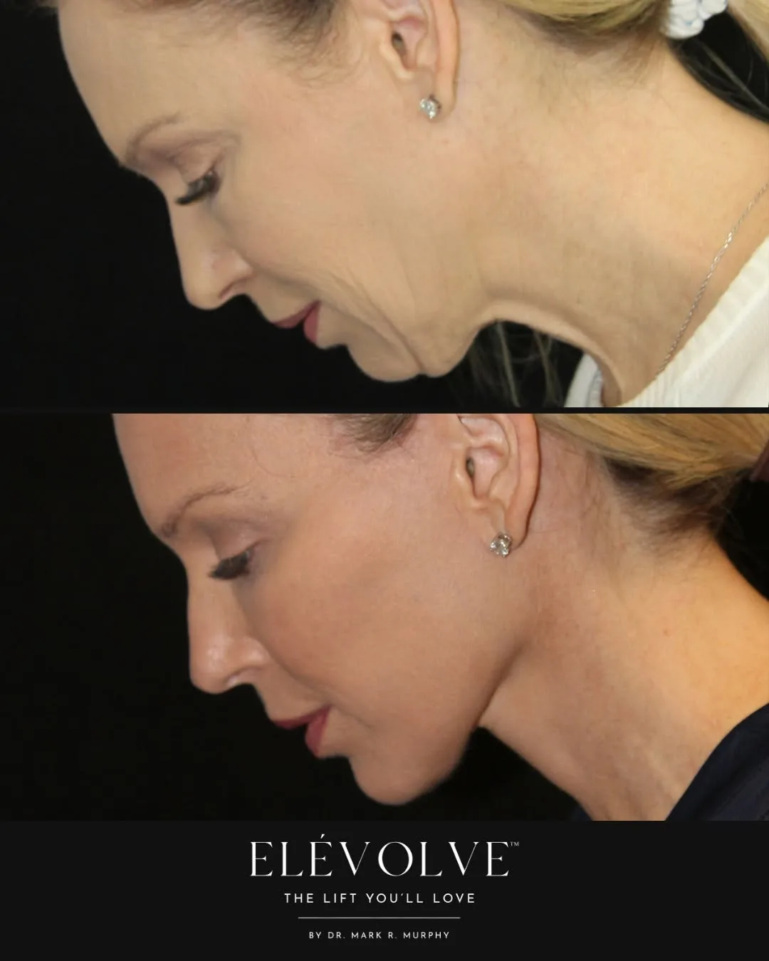 Before and after — Dr. Mark R. Murphy