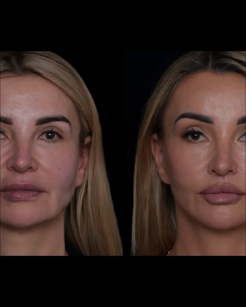 Before and after: Dr. Mateusz Zachara