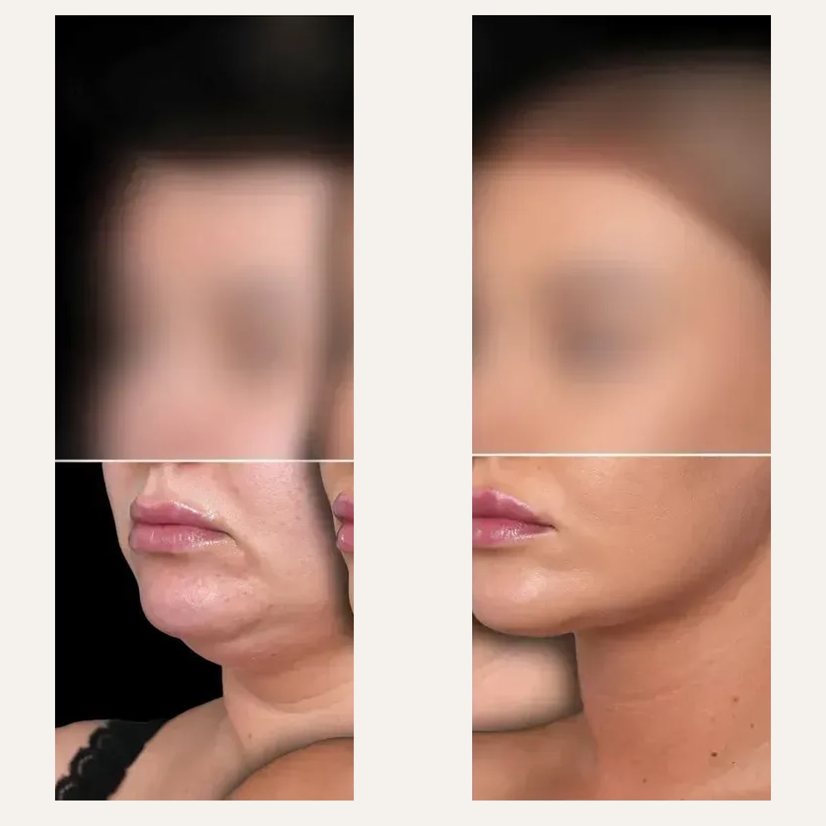 Before and after: Dr. Mateusz Zachara
