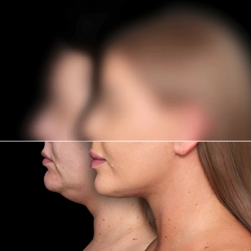 Before and after: Dr. Mateusz Zachara
