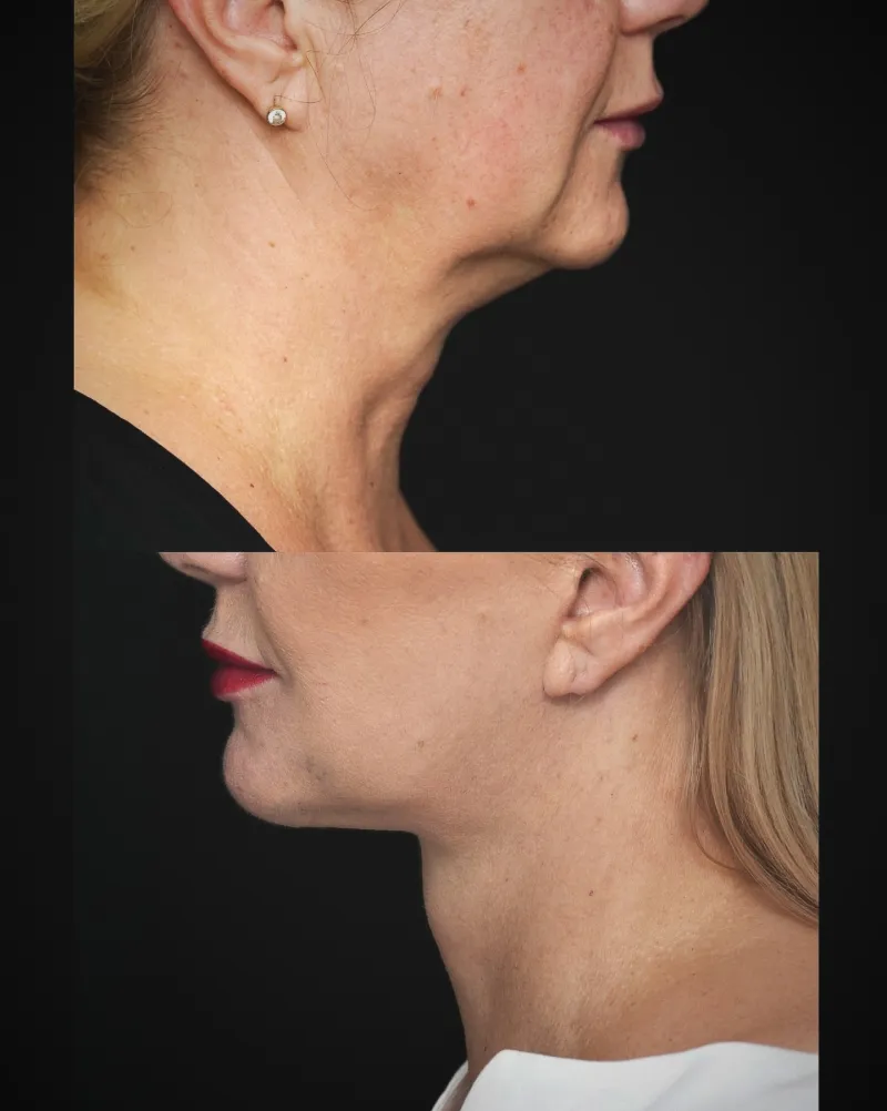 Before and after: Dr. Mateusz Zachara