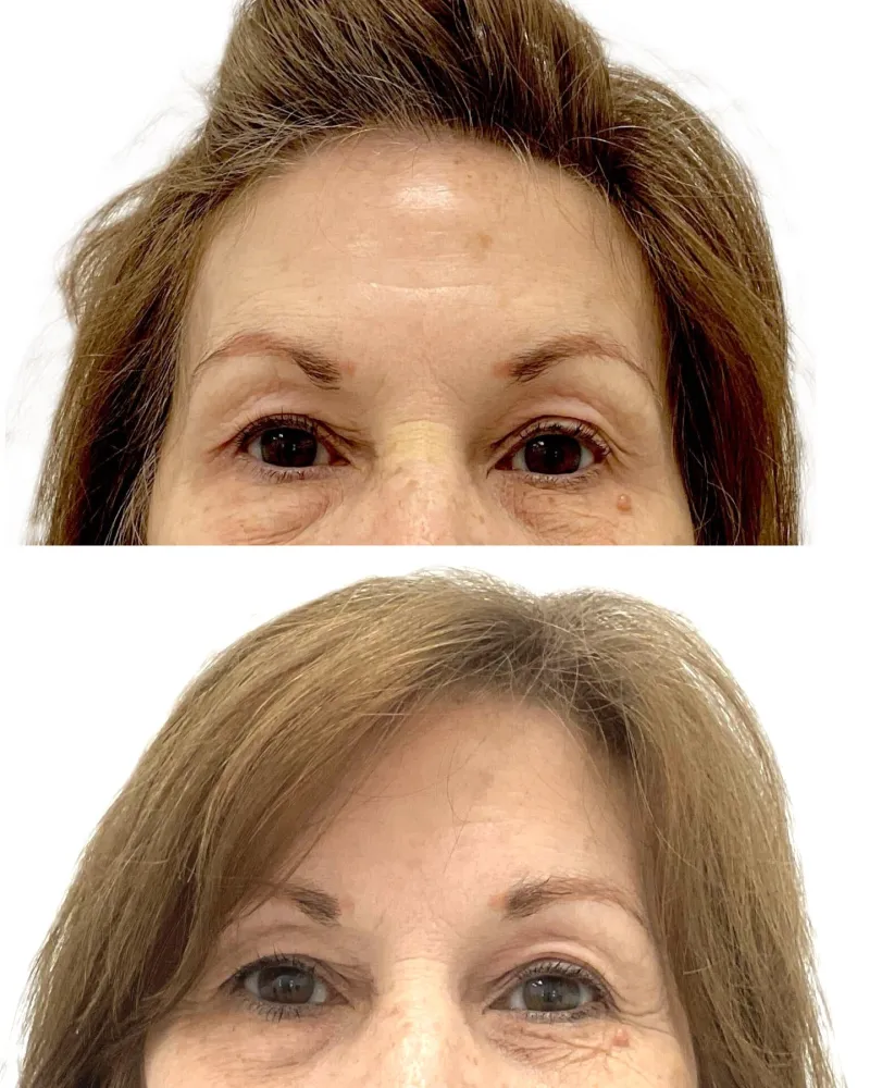 Before and after — Dr. Mathew Epps