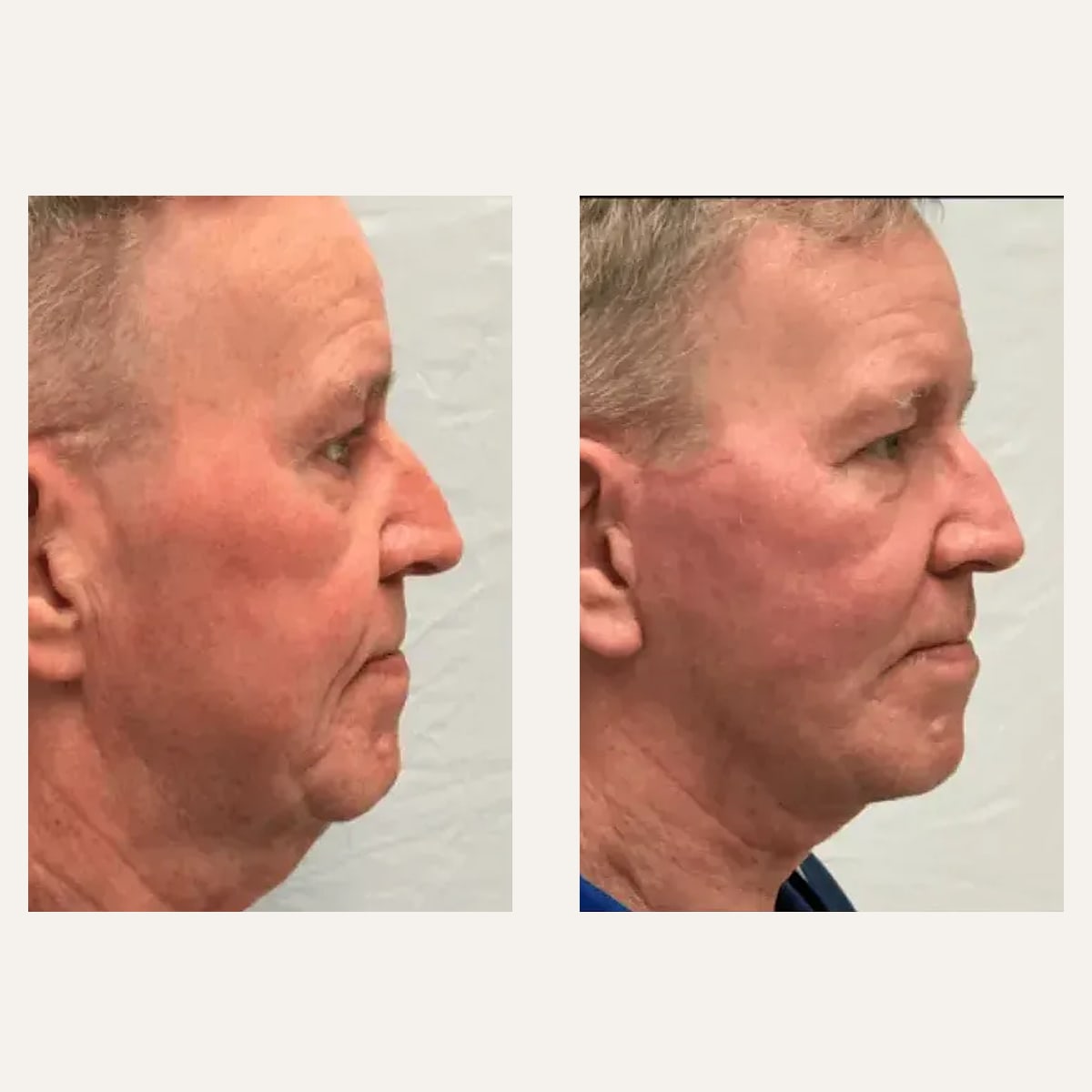 Before and after: Dr. Matthew McRae
