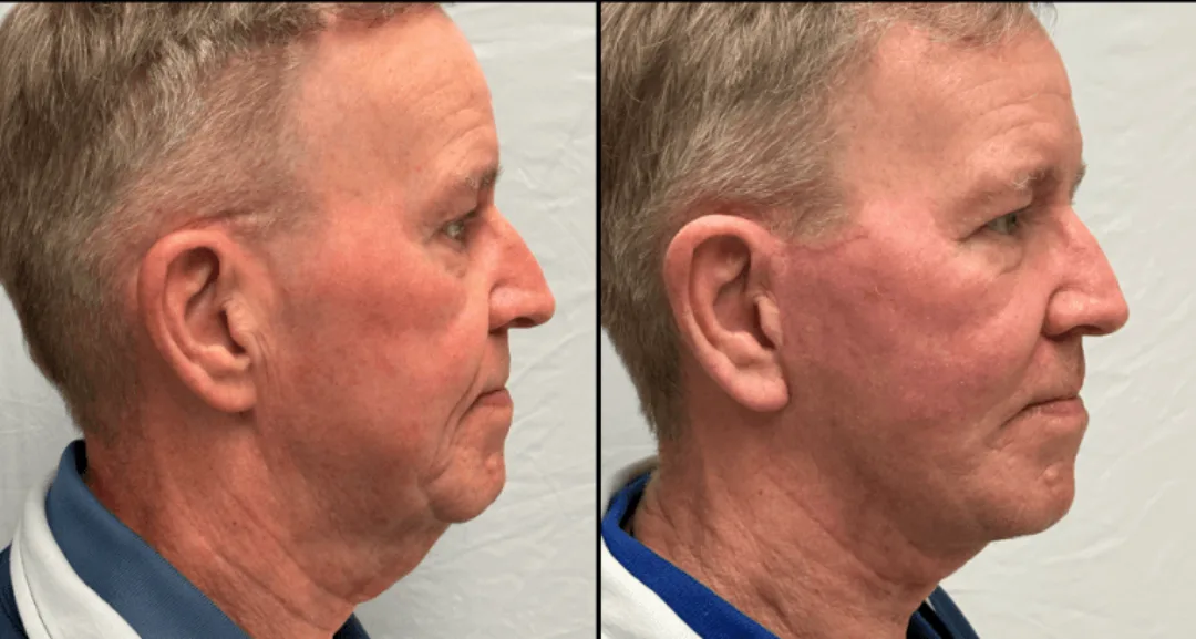 Before and after — Dr. Matthew McRae