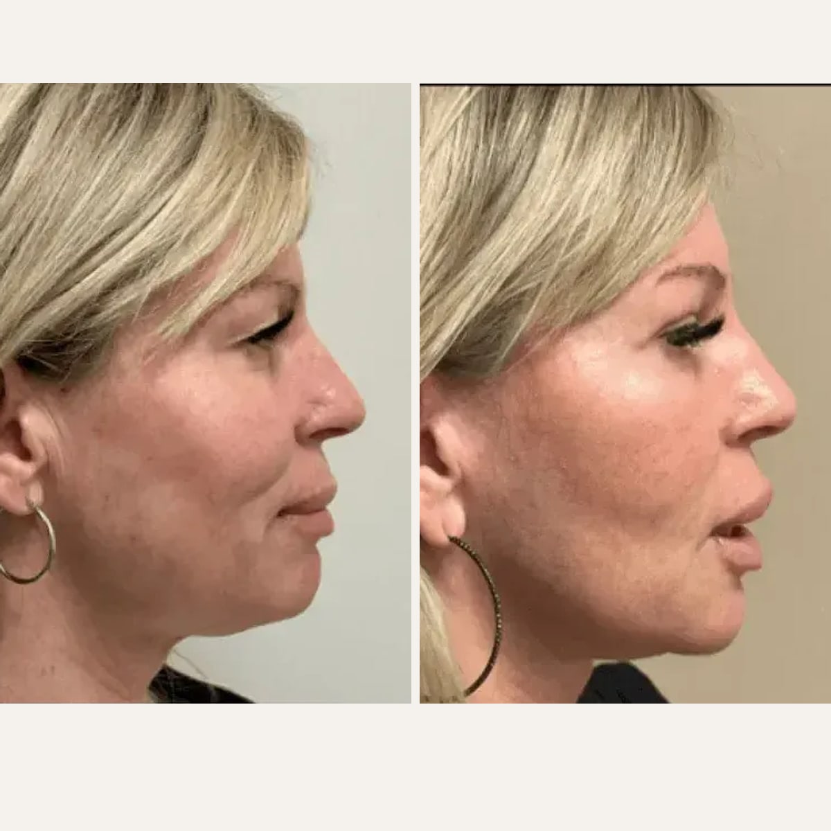 Before and after: Dr. Matthew McRae