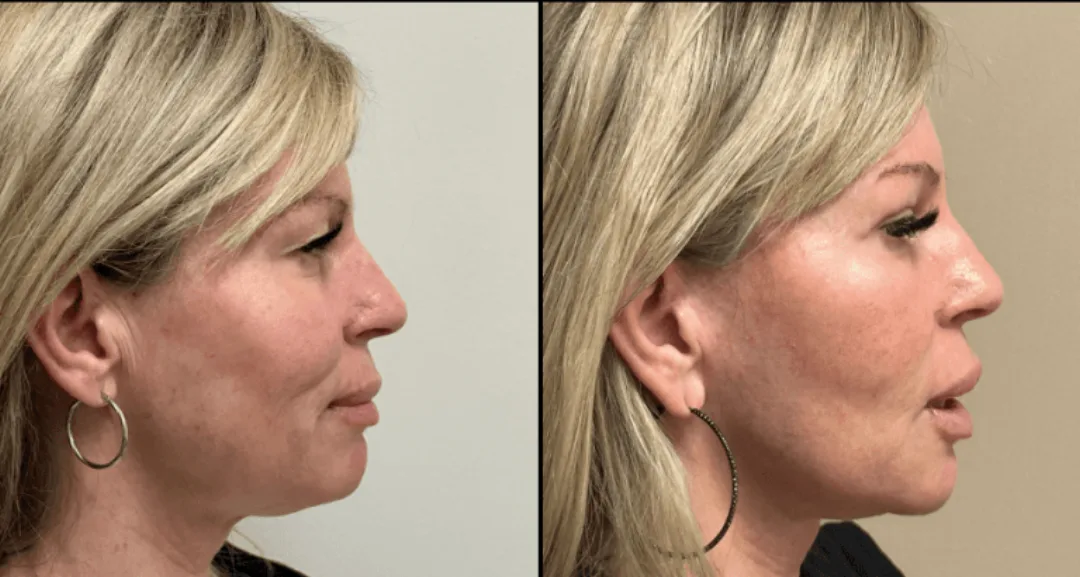 Before and after — Dr. Matthew McRae