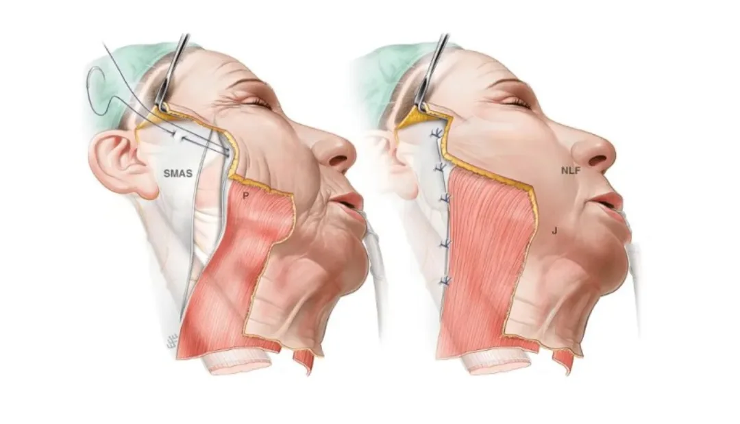 Before and after — Dr. Matthew McRae
