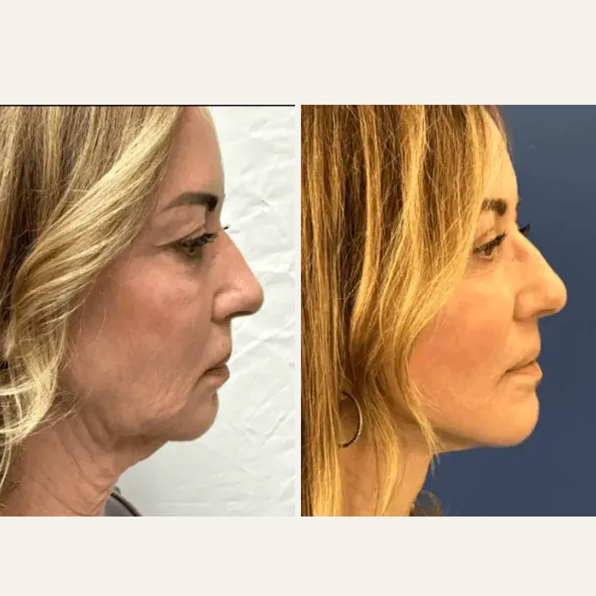 Before and after: Dr. Matthew McRae