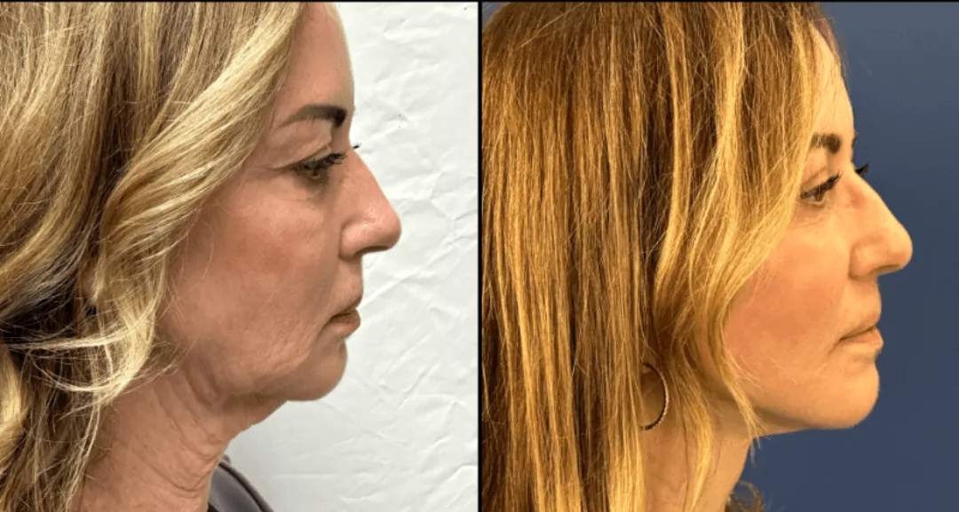 Before and after — Dr. Matthew McRae