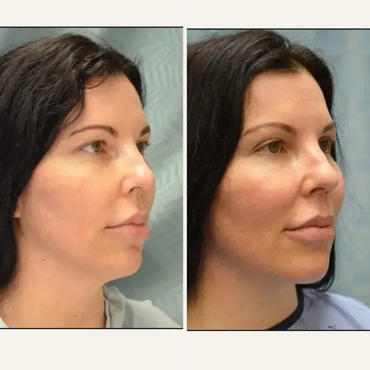 Before and after: Dr. Matthew McRae