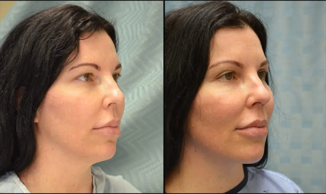 Before and after — Dr. Matthew McRae