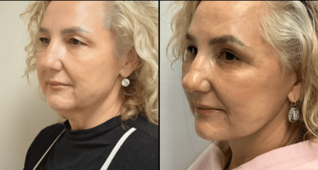 Before and after — Dr. Matthew McRae